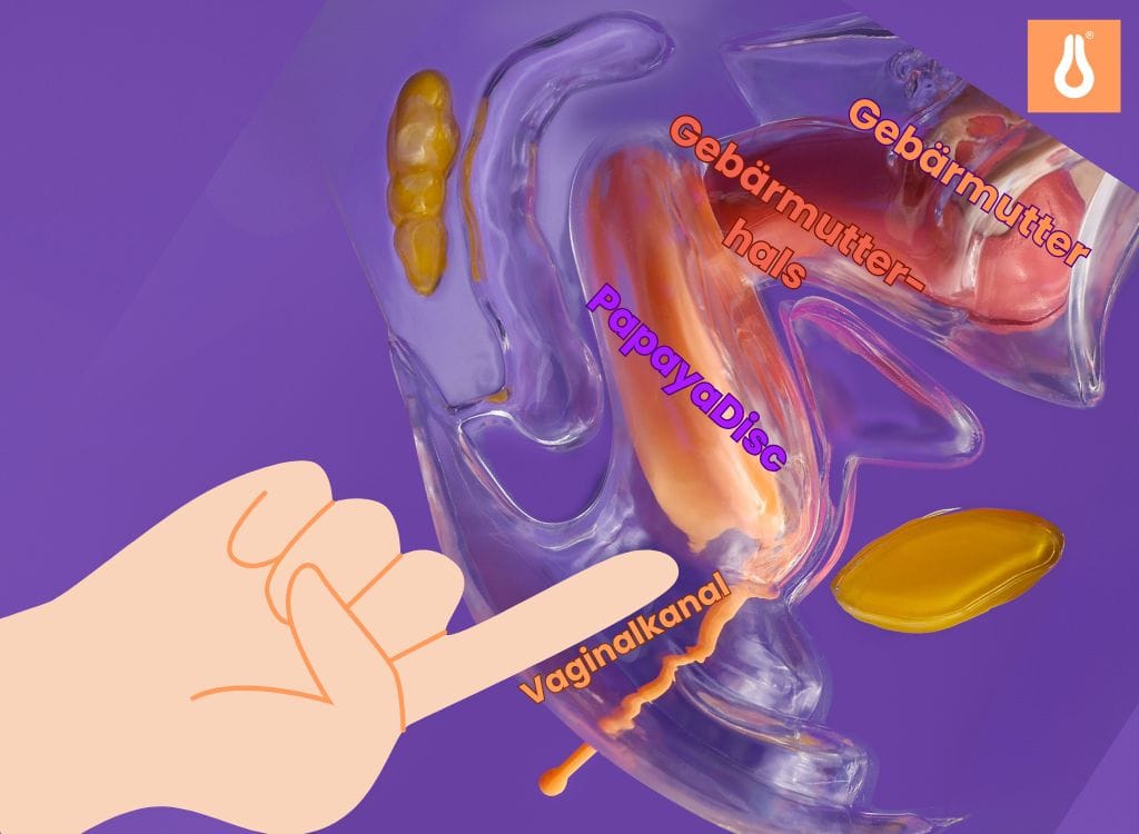 Menstruationsscheibe, Menstrual Disc was ist das?