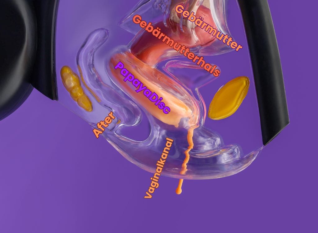 DE