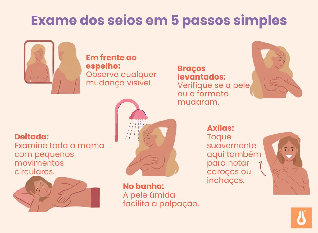 Autoexame_da_mama_em_cinco_passos_simples_Prevenção_do_câncer_de_mama