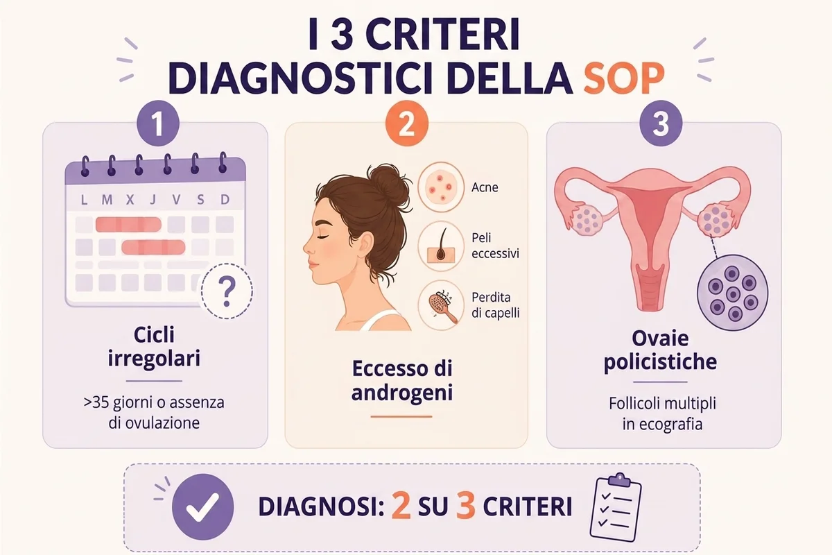 infografica sui criteri per diagnosticare la PCOS