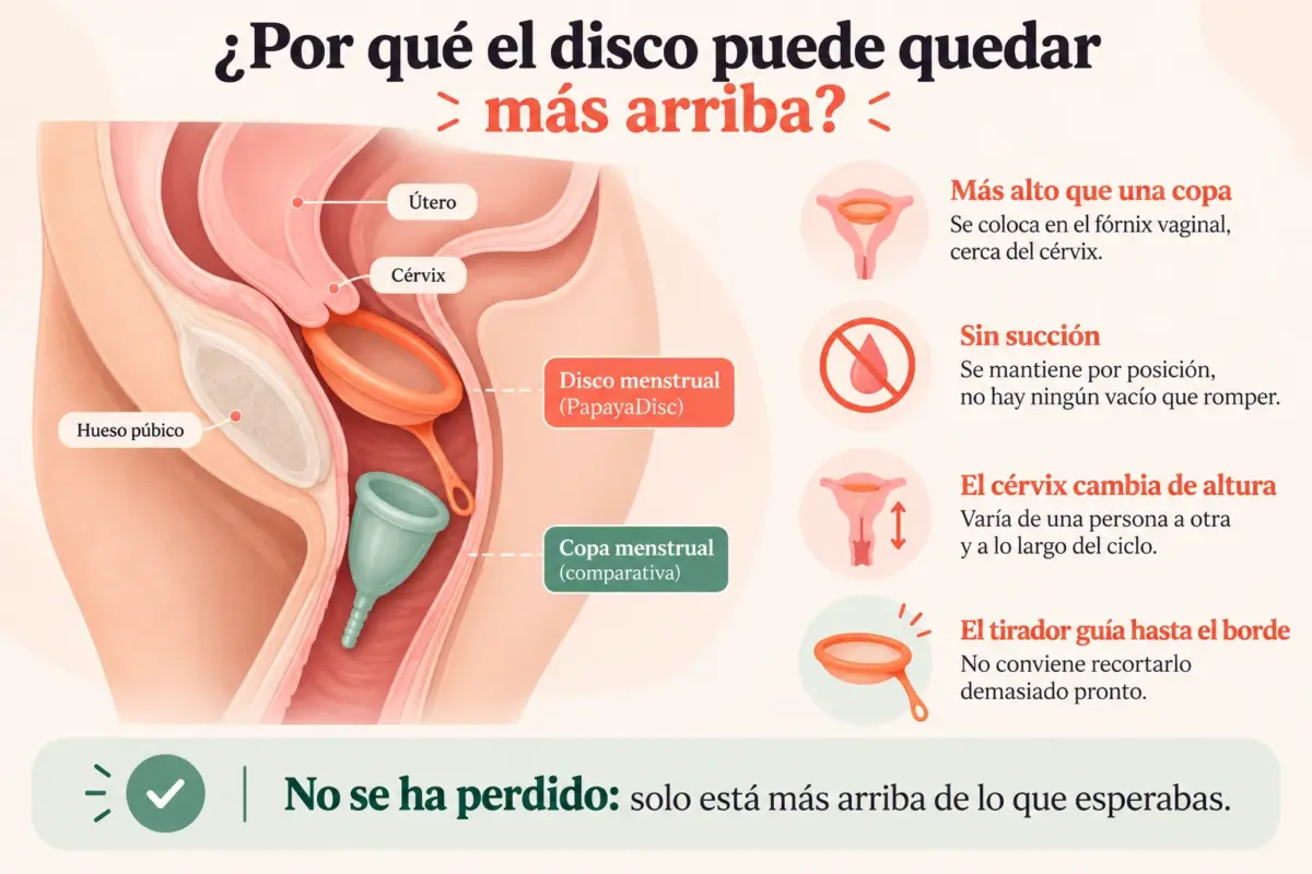 Infografia educativa que explica por qué el disco menstrual puede quedar más arriba