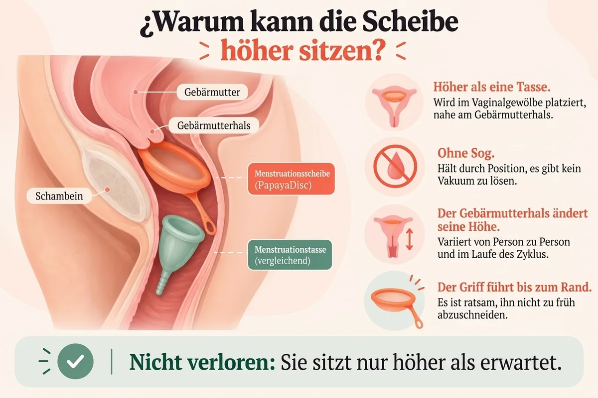 Lehrreiche Infografik, die erklärt, warum die Menstruationsscheibe höher bleiben kann