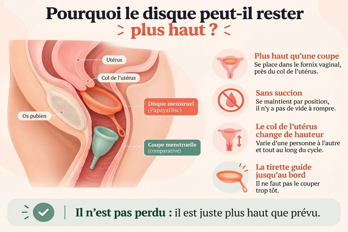 Infographie éducative expliquant pourquoi le disque menstruel peut rester plus haut