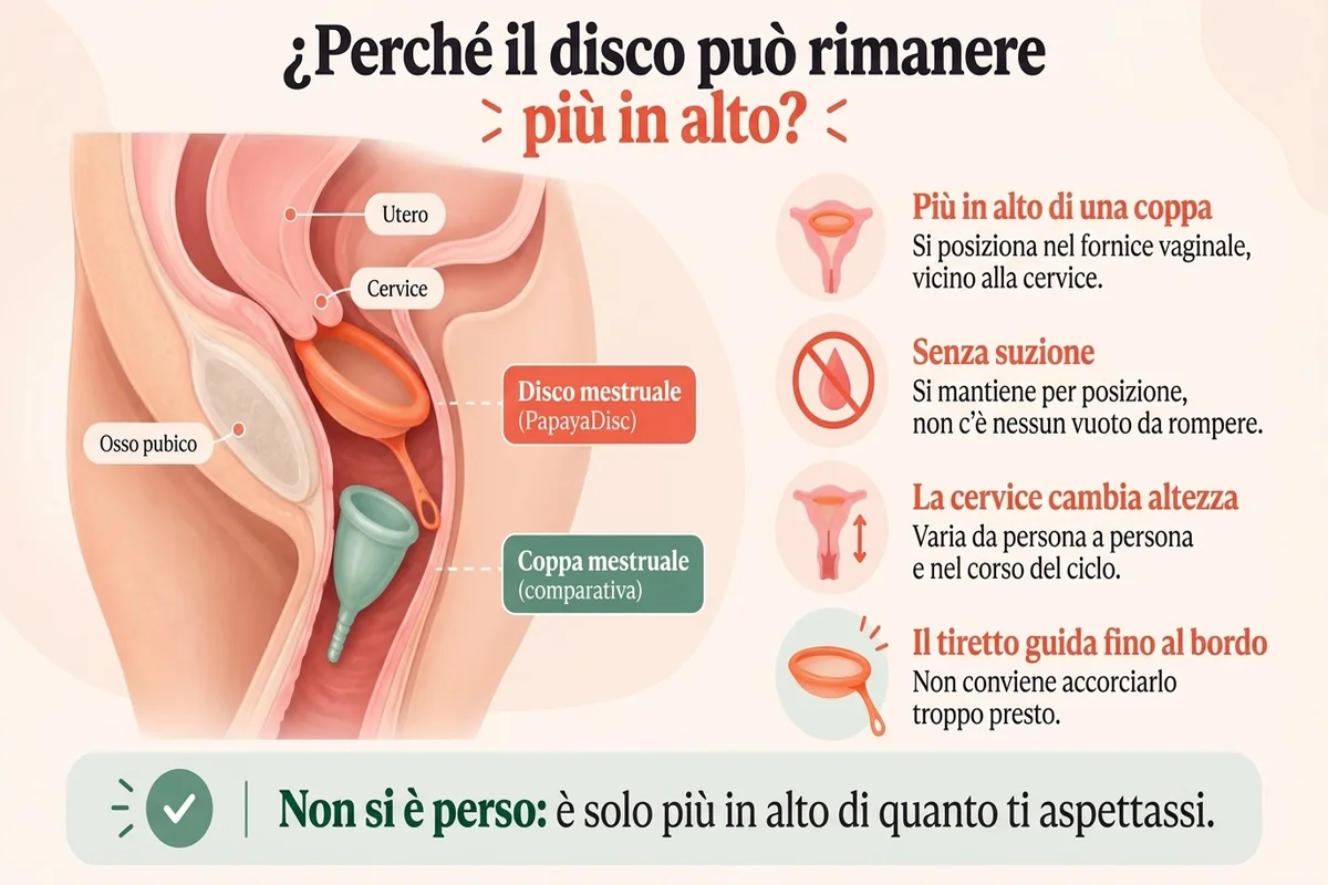 Infografica educativa che spiega perché il disco mestruale può rimanere più in alto