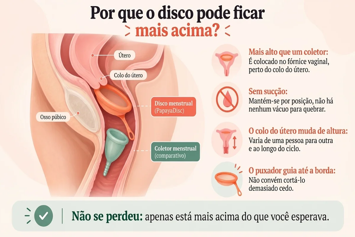 Infografia educativa que explica por que o disco menstrual pode ficar mais alto